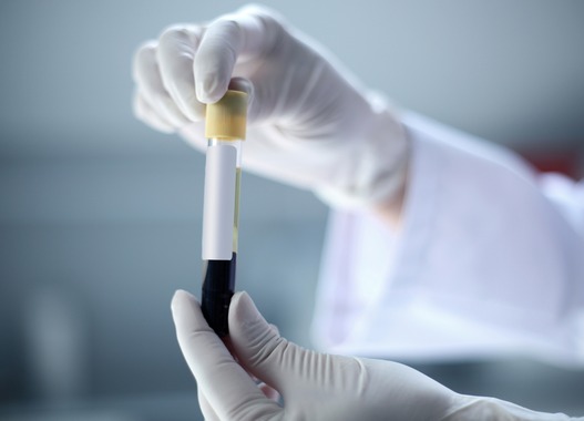 zostavax-vaccine-lawsuit