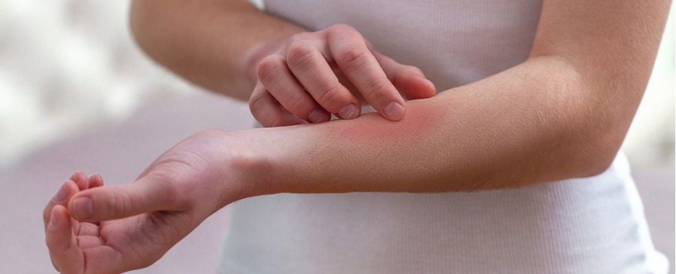 woman itching because of a skin problem