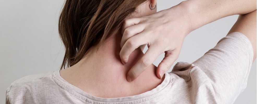 woman itching because of shingles