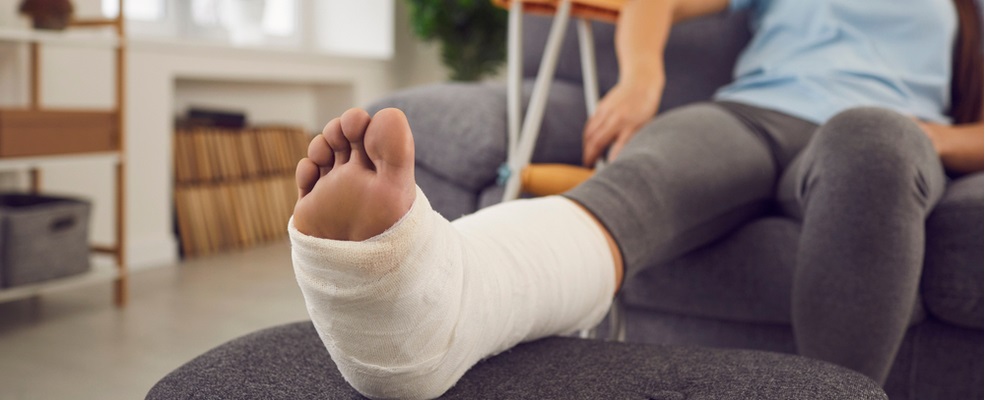 female with a broken leg in a plaster afer an accident